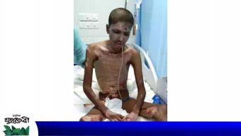 পল্লীবিদ্যুতের অস্থায়ীকর্মী বিদ্যুৎস্পৃষ্ট হয়ে গুরুতর আহত