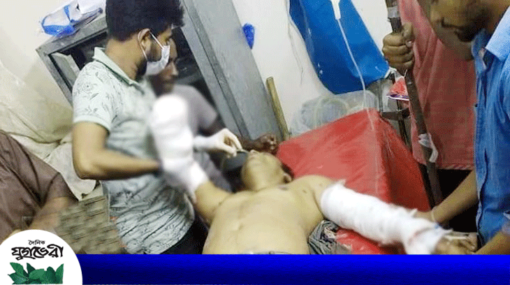 হামলায় শ্রমিক লীগ নেতার বাম হাতের কব্জি বিচ্ছিন্ন