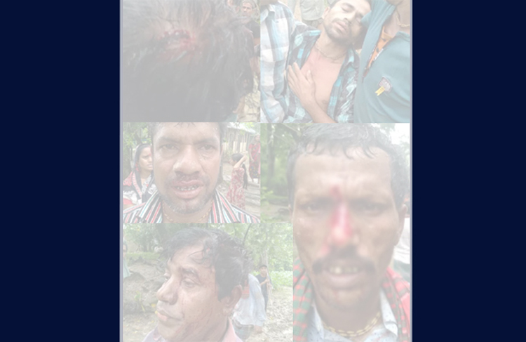 নবীগঞ্জে মাছ ধরাকে কেন্দ্র করে দুই পক্ষের সংঘর্ষ, আহত ৫০, গুরুতর আহত ১৩ জনকে সিলেট প্রেরণ