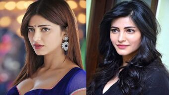 সার্জারি করিয়েছেন শ্রুতি !