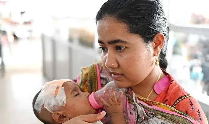 সিলেটে হামের উপসর্গে আরও ২ শিশুর মৃত্যু